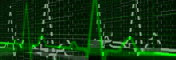 pulse-trace-163708_1280